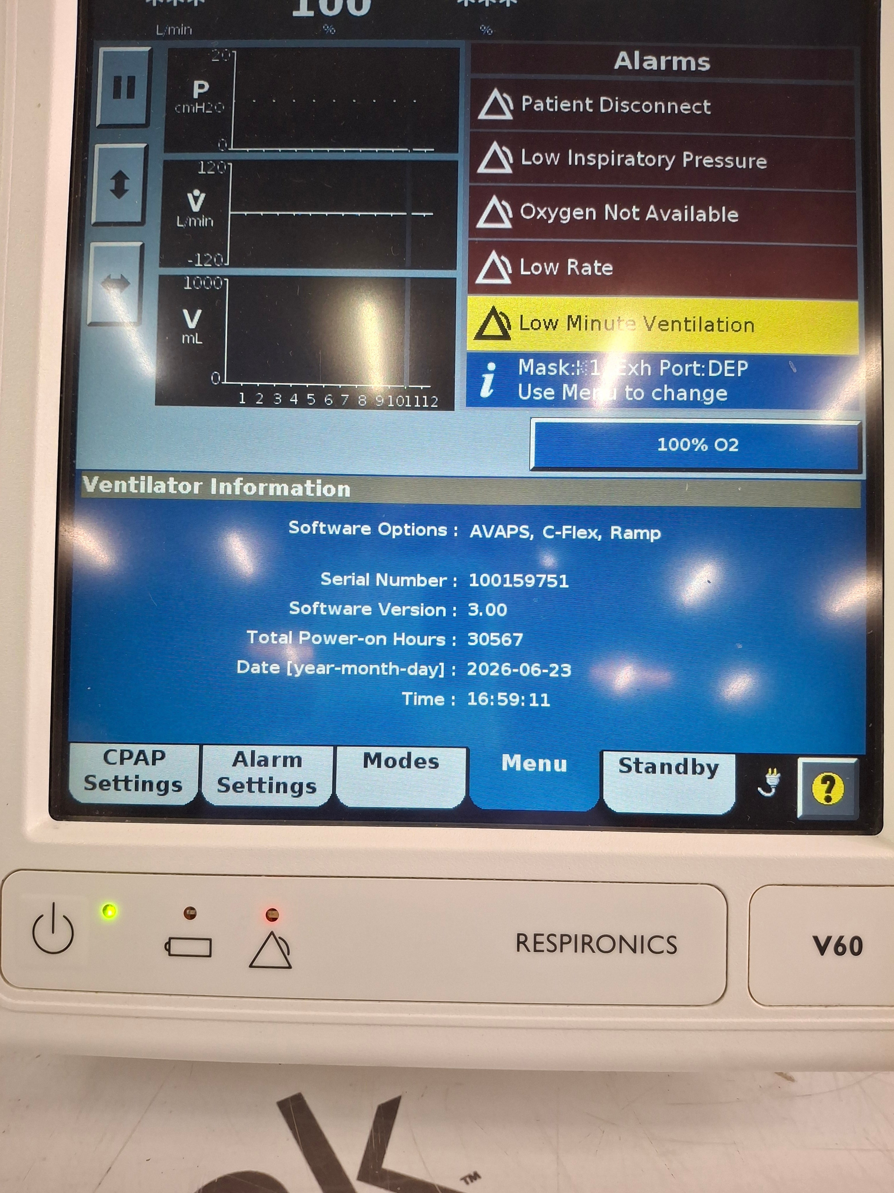 Respironics V60 BiPAP Ventilator Monitor
